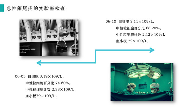 急性阑尾炎护理查房治疗PPT模板_第12页PPT效果图