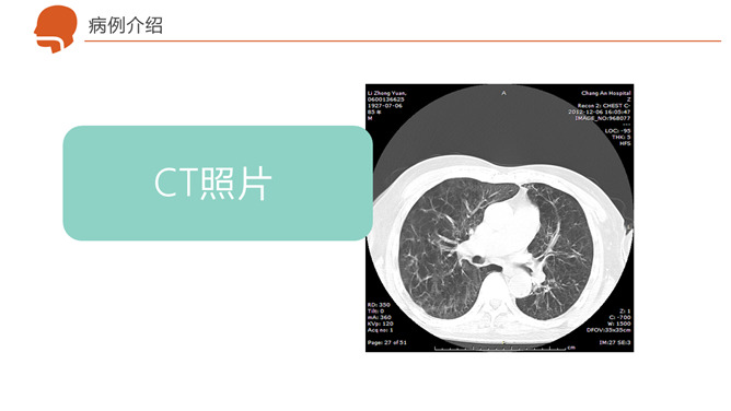 呼吸衰竭护理治疗病例PPT模板_第5页PPT效果图